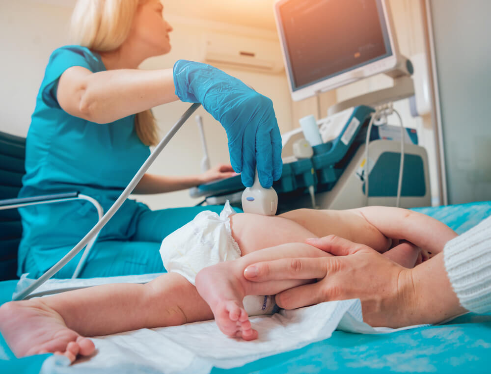 Ultrazvuk kukova bebe