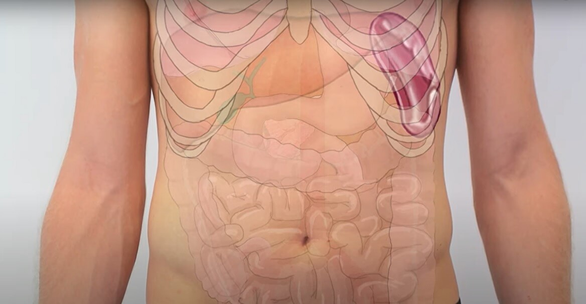 uvecana slezina simptomi, povecana slezina, uvecana slezina kod dece, uvecana slezina kod mononukleoze, kako boli slezina, slezina pod pritiskom, kako se leci uvecana slezina, bol ispod levog rebarnog luka - Dr Nestorov 2