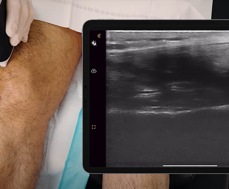 ultrazvuk kolena, pregled kolena ultrazvukom, ultrazvuk kolena Beograd, ultrazvuk zglobova kolena, ultrazvucni pregled ligamenata zglobova, dijagnostika kolena ultrazvukom - Dr Nestorov 1