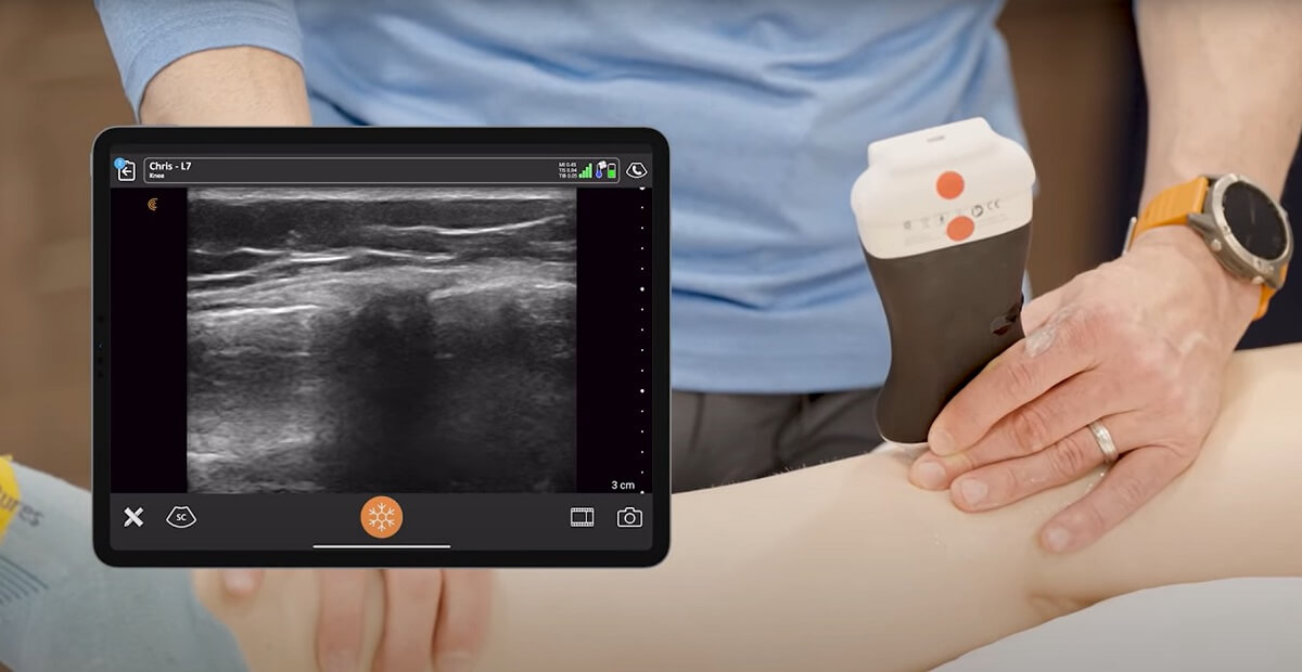ultrazvuk kolena, pregled kolena ultrazvukom, ultrazvuk kolena Beograd, ultrazvuk zglobova kolena, ultrazvucni pregled ligamenata zglobova, dijagnostika kolena ultrazvukom - Dr Nestorov 3