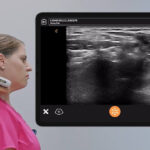 ultrazvuk misica vrata, ultrazvuk vrata, ultrazvucni pregled mekih tkiva vrata, kako se resiti bola u vratu, ultrazvucni pregled vrata - Dr Nestorov 1