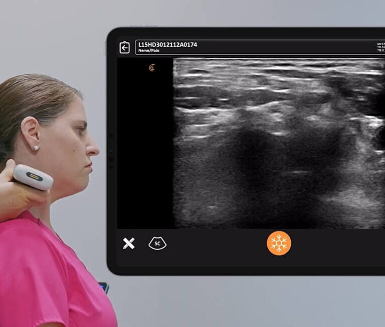 ultrazvuk misica vrata, ultrazvuk vrata, ultrazvucni pregled mekih tkiva vrata, kako se resiti bola u vratu, ultrazvucni pregled vrata - Dr Nestorov 1