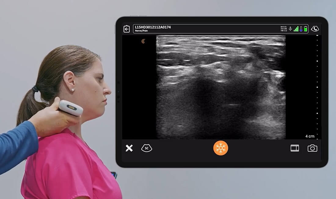 ultrazvuk misica vrata, ultrazvuk vrata, ultrazvucni pregled mekih tkiva vrata, kako se resiti bola u vratu, ultrazvucni pregled vrata - Dr Nestorov 1