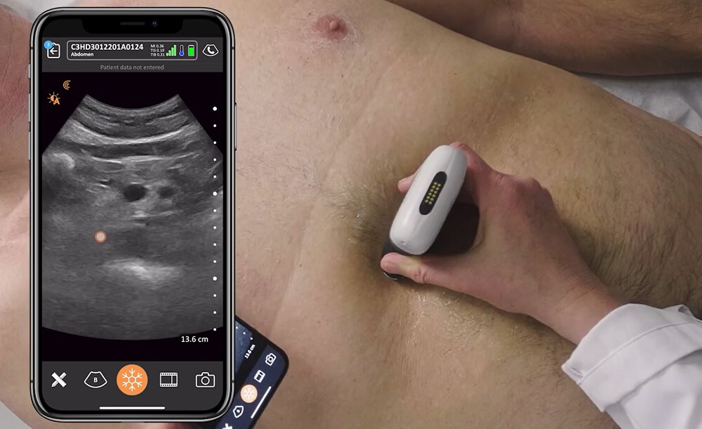 ultrazvuk trbusne aorte, ultrazvuk abdominalne aorte, skrining trbusne aorte, dopler trbusne aorote, dopler abdominalne aorte - Dr Nestorov 3