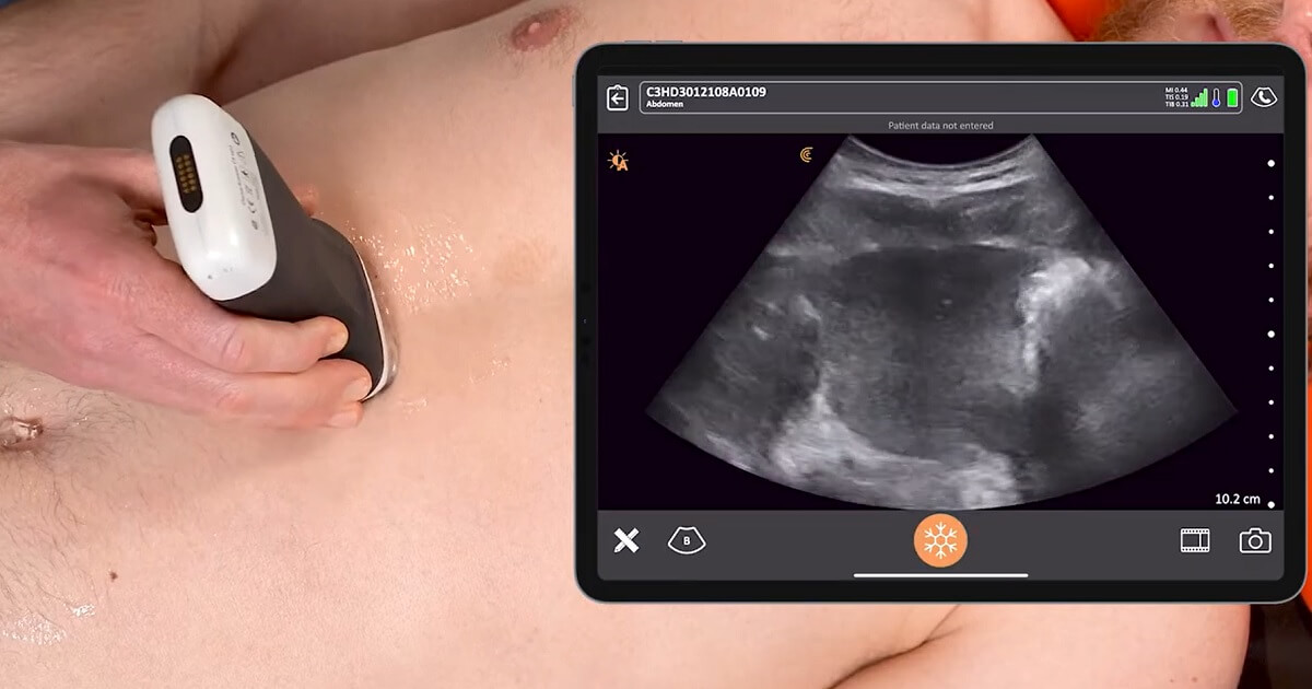 ultrazvuk trbusne aorte, ultrazvuk abdominalne aorte, skrining trbusne aorte, dopler trbusne aorote, dopler abdominalne aorte - Dr Nestorov 4