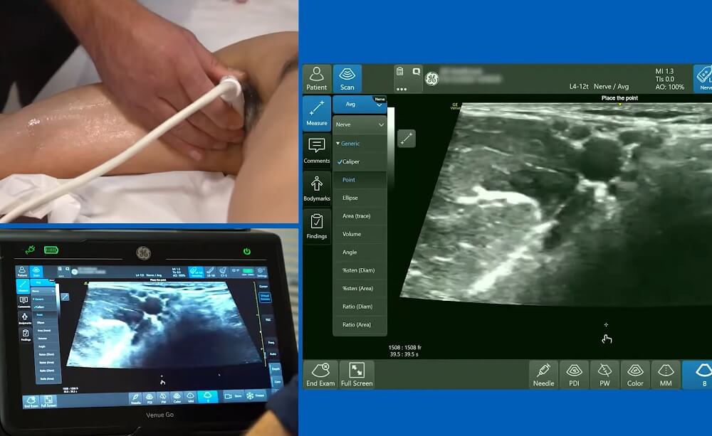 ultrazvuk limfnih zlezda, ultrazvuk limfnih cvorova, ultrazvuk limfnih zlezda cena, ultrazvuk pazuha i prepona, ultrazvuk vrata limfni cvorovi - Dr Nestorov 3